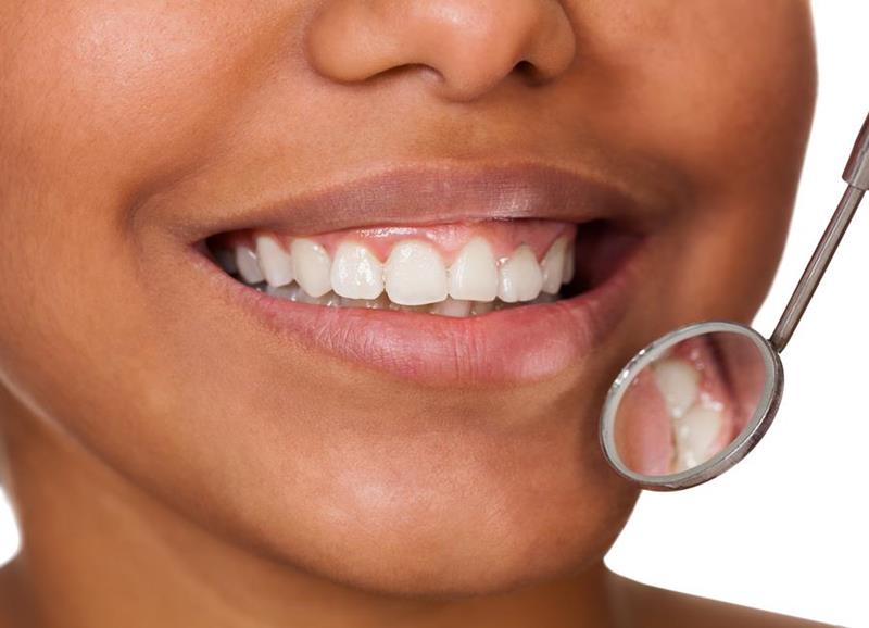 GEHA dental insurance