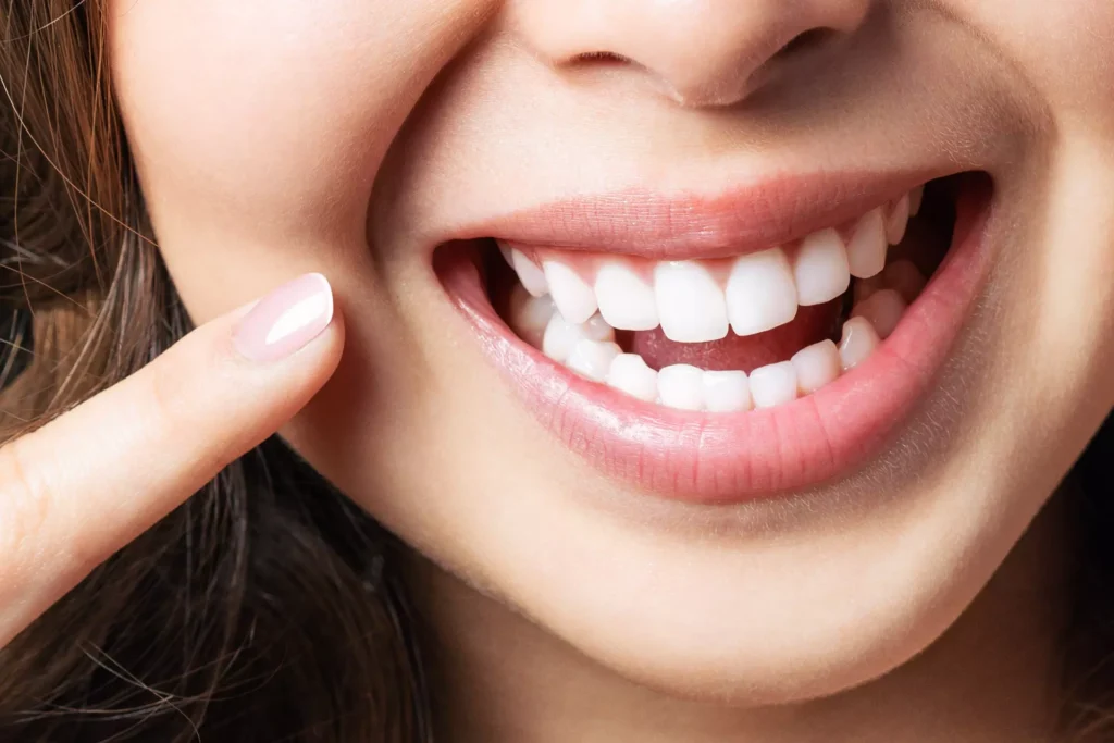 Achieve a Perfect Smile with Invisalign in Englishtown, NJ
