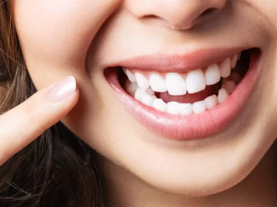 Achieve a Perfect Smile with Invisalign in Englishtown, NJ