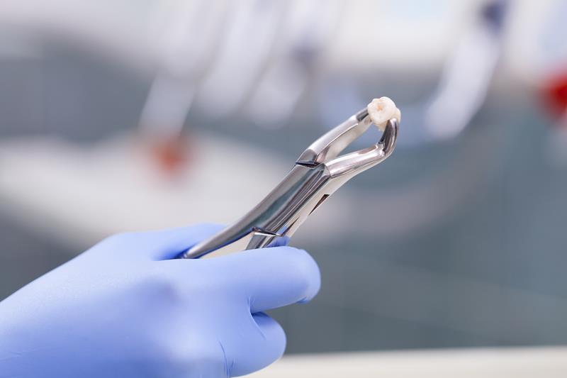 Dental instruments for a tooth extraction
