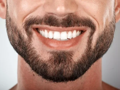 Understanding Bone Grafting: A Key Component in Successful Dental Implant Treatment