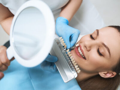 The Ultimate Guide to Achieving Perfection with Dental Veneers