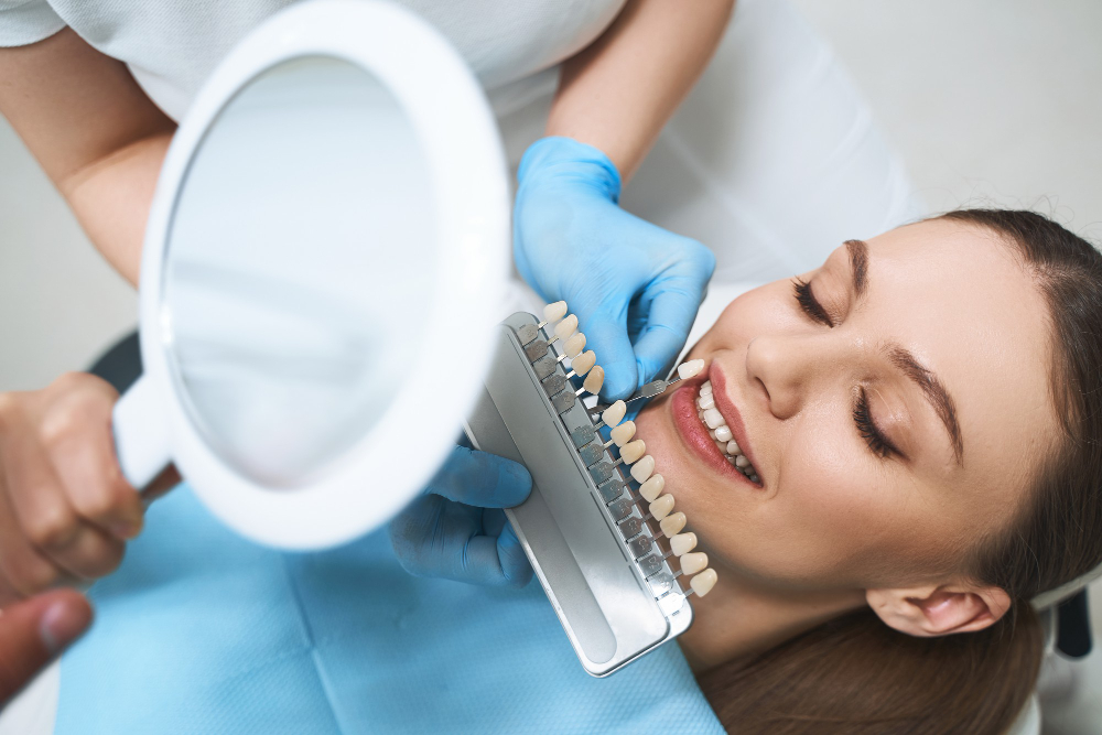 The Ultimate Guide to Achieving Perfection with Dental Veneers